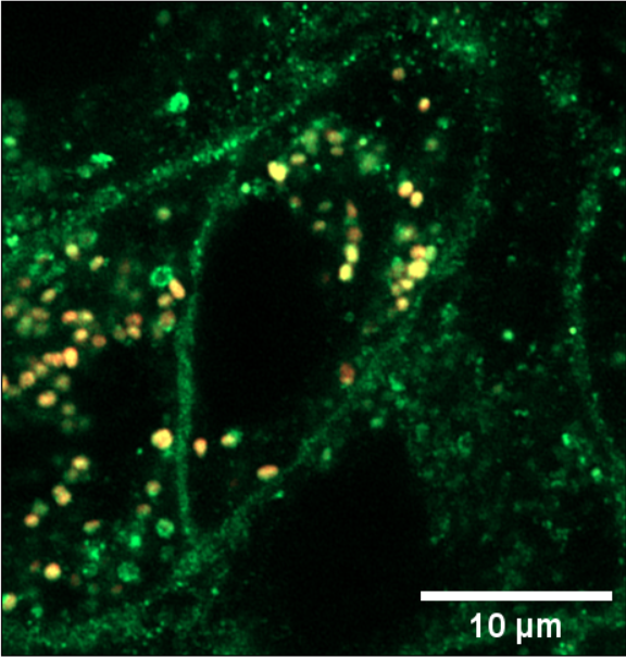 Red fluorescence image of Qdot-EGFR nanobody conjugate in cells